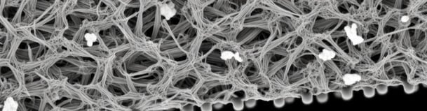 Membrane Particles