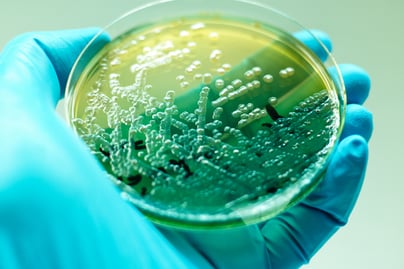 Sterilization SMALL 524153776