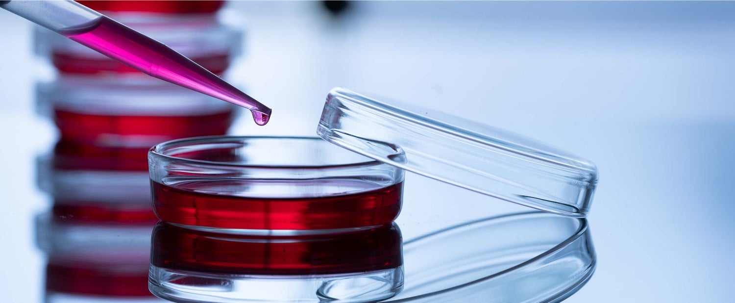 How do I choose the best sterilizing filter for my application?